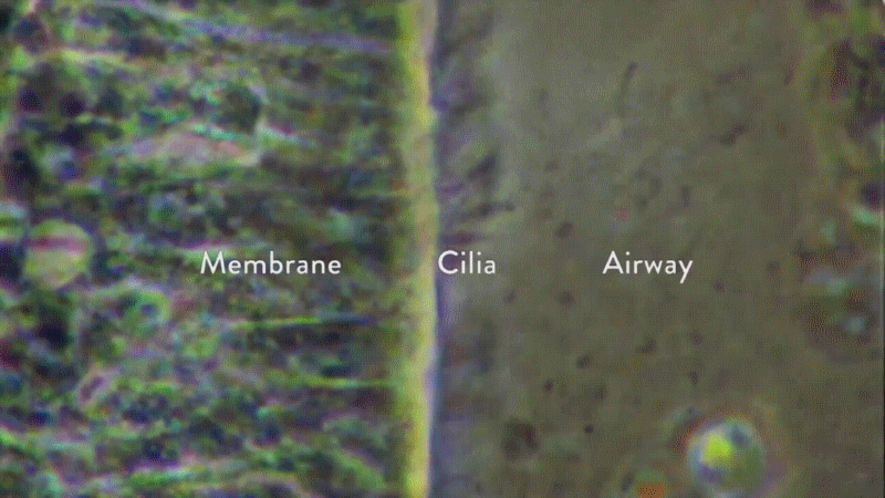 002 05-31 Membrane-Cilia-Airway