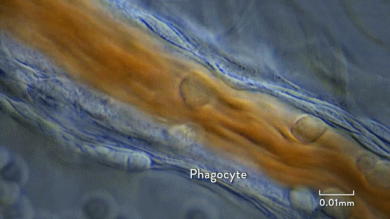 007 09-52 Phagocyte in patrol